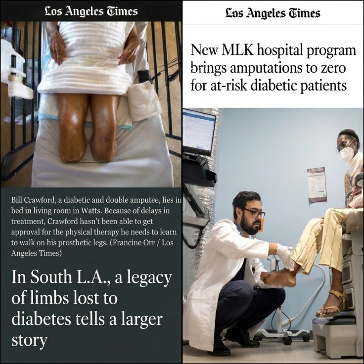 Then and Now — Los Angeles Times: a 2021 story on limbs lost to diabetes in South LA, beside a 2026 story on MLK's program bringing amputations to zero