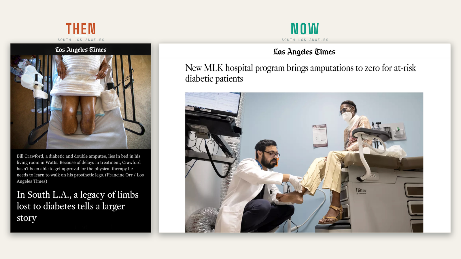 Then and Now — Los Angeles Times: a 2021 story on limbs lost to diabetes in South LA, beside a 2026 story on MLK's program bringing amputations to zero